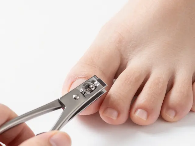 Jak předcházet zarůstání nehtů u nohou a jak se z něj zbavit